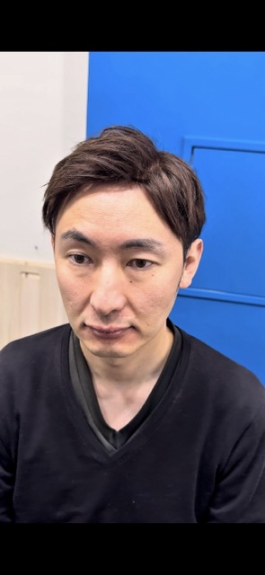 【ウィッグビフォーアフター動画公開】「ハゲには清潔感がないと言われました」