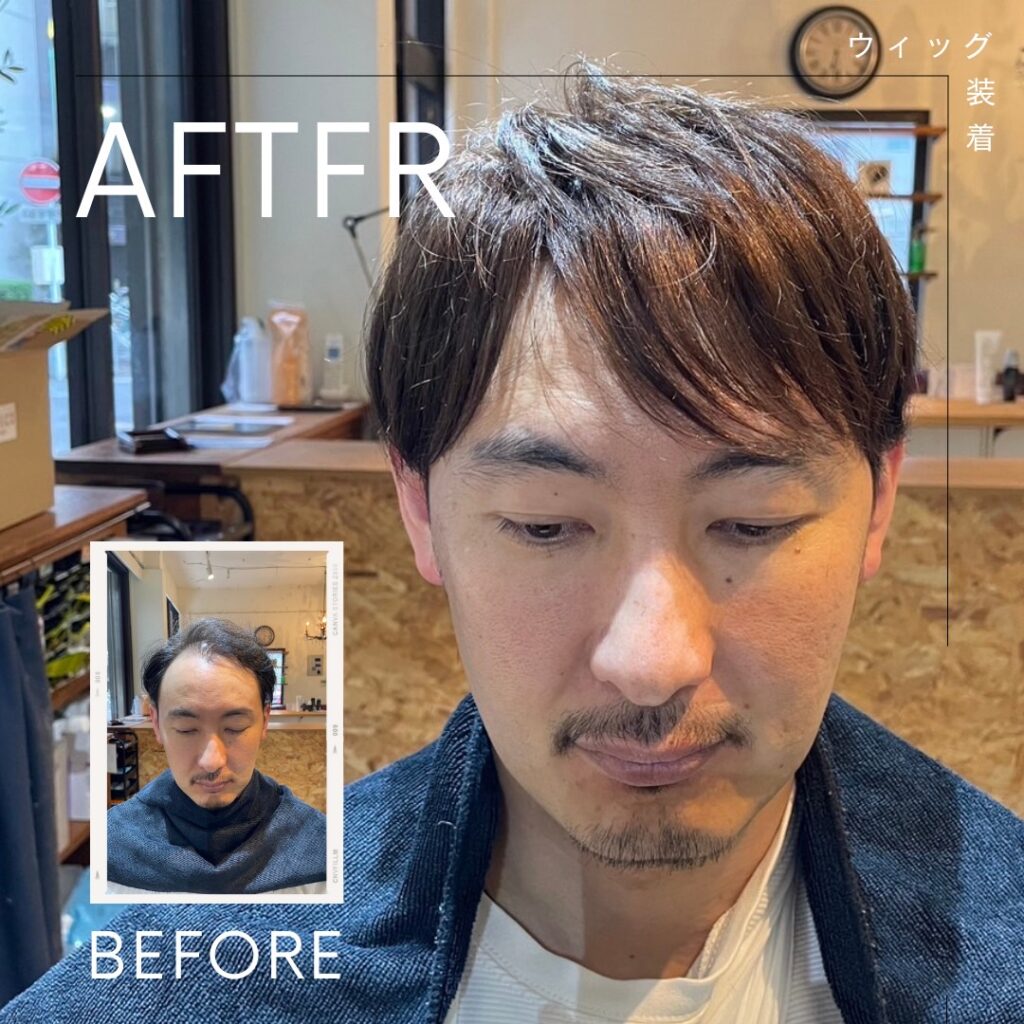 初めてウィッグデビューした時の家族・知り合いの反応について