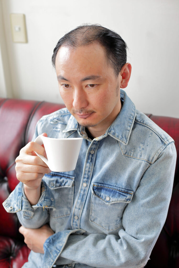 AGA治療で良かったこと、キツかったことの体験談